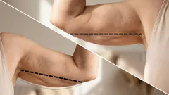 Slappe armen? 3 simpele oefeningen van een fitnesstrainer